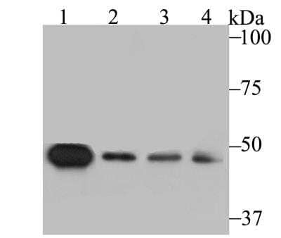 Western Blot: sFRP-4 Antibody (JE41-41) [NBP2-76870] - Western blot analysis of SFRP4 on different lysates using anti-SFRP4 antibody at 1/1,000 dilution.Positive control:Lane 1: Mouse testis Lane 2: A549Lane 3: HepG2 Lane 4: SH-SY-5Y