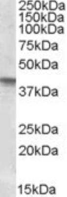 Western Blot: sFRP-4 Antibody [NBP1-36985] -  Western blot analysis of SFRP4 in Human Uterus lysate (35ug protein in RIPA buffer) using NBP1-36985 at 0.3ug/ml. Primary incubation was 1 hour. Detected by chemiluminescence.