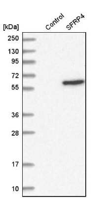 Western Blot: sFRP-4 Antibody [NBP1-81866] - Analysis in control (vector only transfected HEK293T lysate) and sFRP4 over-expression lysate (Co-expressed with a C-terminal myc-DDK tag (3.1 kDa) in mammalian HEK293T cells).