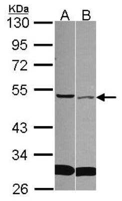 Western Blot: sFRP-4 Antibody [NBP2-20330] - Sample (30 ug of whole cell lysate) A: A549 B: Hep G2 10% SDS PAGE gel, diluted at 1:1000.