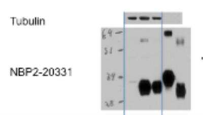 Western Blot: sFRP-5 Antibody [NBP2-20331] - Lane 1: pcDNA3.1, Lane 2: sFRP-5 - Myc in 293T cells, Lane 3: Load half volume of lane 2, Lane 4: recombinant mouse sFRP-5, Lane 5: human sFRP-5. Image submitted by a verified customer review. 