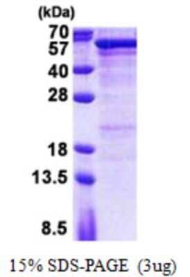 SDS-Page: Recombinant Human Semenogelin I Protein [NBP2-23457]