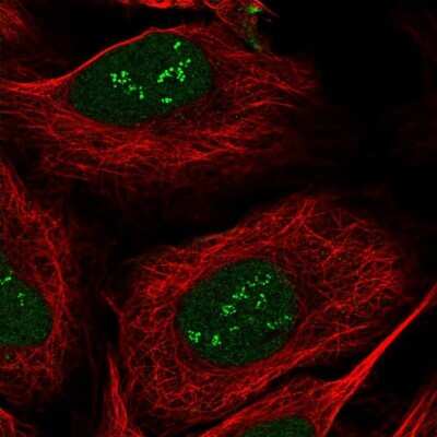 Immunocytochemistry/ Immunofluorescence sen15 Antibody