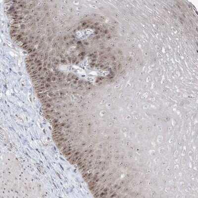 Immunohistochemistry-Paraffin sen15 Antibody