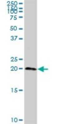 Western Blot sen15 Antibody