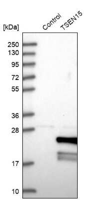 Western Blot sen15 Antibody