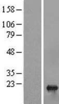 Western Blot sen15 Overexpression Lysate