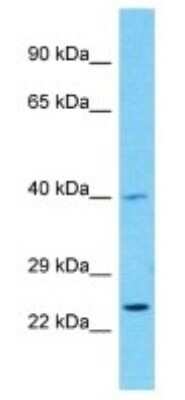Western Blot: serine protease 55 Antibody [NBP3-09884] - Western blot analysis of serine protease 55 in HepG2 Whole Cell lysates. Antibody dilution at 1.0ug/ml