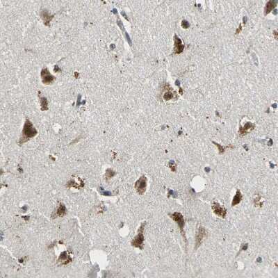 Immunohistochemistry-Paraffin smu1 Antibody