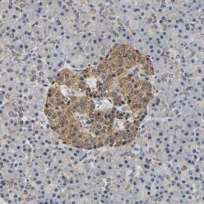 Immunohistochemistry-Paraffin smu1 Antibody