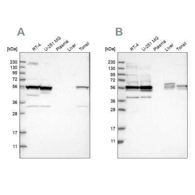 Western Blot smu1 Antibody