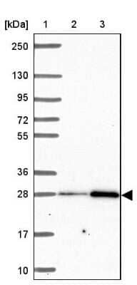 Western Blot: solute carrier family 22, member 18 antisense Antibody [NBP2-39093] - Lane 1: Marker  [kDa] 250, 130, 95, 72, 55, 36, 28, 17, 10.  Lane 2: Human cell line RT-4.  Lane 3: Human cell line U-251MG