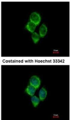 Immunocytochemistry/Immunofluorescence: solute carrier family 22, member 18 antisense Antibody [NBP2-15120] - Analysis of methanol-fixed A431, using antibody at 1:500 dilution.