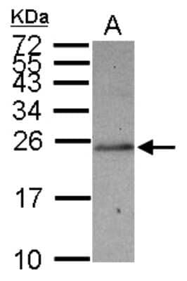 Western Blot: solute carrier family 22, member 18 antisense Antibody [NBP2-15120] - Sample (30 ug of whole cell lysate) A: A431 15% SDS PAGE; antibody diluted at 1:1000.