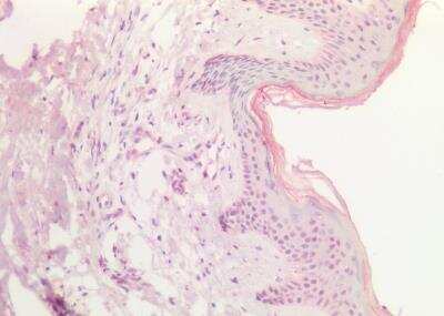 Immunohistochemistry-Paraffin: sox9b Antibody [NBP2-88826] - Staining of paraffin embedded Human Skin. Antibody at 5 ug/mL. Steamed antigen retrieval with citrate buffer pH 6, AP-staining.