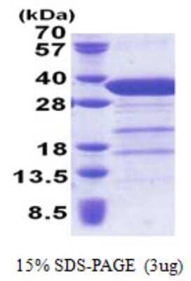 SDS-PAGE Recombinant Human Syntaxin 6 His Protein