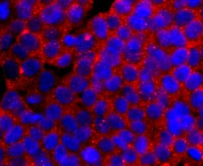 Immunocytochemistry/Immunofluorescence: t-Plasminogen Activator/tPA Antibody (AH54-10) [NBP2-67279] - Staining TPA in 293T cells (red). The nuclear counter stain is DAPI (blue). Cells were fixed in paraformaldehyde, permeabilised with 0.25% Triton X100/PBS.