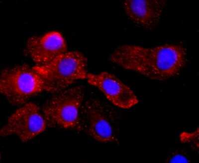 Immunocytochemistry/Immunofluorescence: t-Plasminogen Activator/tPA Antibody (AH54-10) [NBP2-67279] - Staining TPA in A549 cells (red). The nuclear counter stain is DAPI (blue).Cells were fixed in paraformaldehyde, permeabilised with 0.25% Triton X100/PBS.