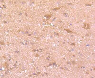 Immunohistochemistry-Paraffin: t-Plasminogen Activator/tPA Antibody (JF0958) [NBP2-67220] - Analysis of paraffin-embedded rat brain tissue using anti-PLAT antibody. Counter stained with hematoxylin.