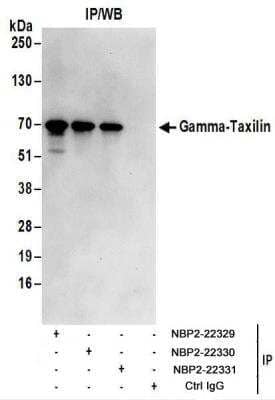 <b>Biological Strategies Validation. </b>Immunoprecipitation: taxilin gamma Antibody [NBP2-22329] - Whole cell lysate (1 mg for IP; 20% of IP loaded) from 293T cells.  Antibodies:  NBP2-22329 used for IP at 6 ug/mg lysate.  Gamma-Taxilin was also immunoprecipitated by rabbit anti-Gamma-Taxilin antibodies NBP2-22330 and NBP2-22331.  For blotting immunoprecipitated Gamma-Taxilin, NBP2-22329 was used at 1 ug/ml.  Detection: Chemiluminescence with an exposure time of 30 seconds.