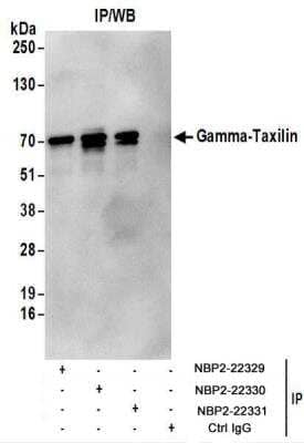 <b>Biological Strategies Validation. </b>Immunoprecipitation: taxilin gamma Antibody [NBP2-22330] - Whole cell lysate (1 mg for IP; 20% of IP loaded) from 293T cells.  Antibodies:  NBP2-22330 used for IP at 6 ug/mg lysate.  Gamma-Taxilin was also immunoprecipitated by rabbit anti-Gamma-Taxilin antibodies NBP2-22329 and NBP2-22331.  For blotting immunoprecipitated Gamma-Taxilin, NBP2-22330 was used at 1 ug/ml.  Detection: Chemiluminescence with an exposure time of 10 seconds.
