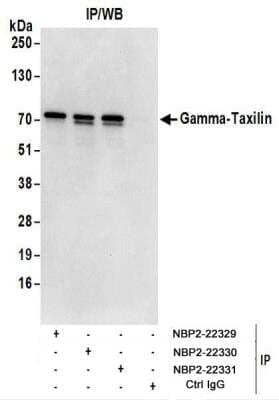 <b>Biological Strategies Validation. </b>Immunoprecipitation: taxilin gamma Antibody [NBP2-22331] - Whole cell lysate (1 mg for IP; 20% of IP loaded) from 293T cells.  Antibodies:  NBP2-22331 used for IP at 6 ug/mg lysate.  Gamma-Taxilin was also immunoprecipitated by rabbit anti-Gamma-Taxilin antibodies NBP2-22329 and NBP2-22330.  For blotting immunoprecipitated Gamma-Taxilin, NBP2-22331 was used at 1 ug/ml.  Detection: Chemiluminescence with an exposure time of 3 seconds.