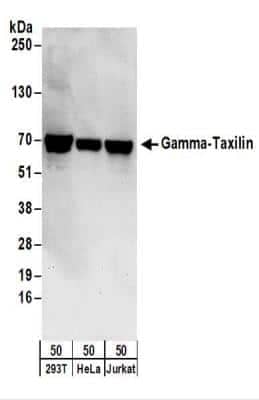 Western Blot: taxilin gamma Antibody [NBP2-22329] - Whole cell lysate (50 ug) from 293T, HeLa, and Jurkat cells. NBP2-22329 used for WB at 0.04 ug/ml.  Detection: Chemiluminescence with an exposure time of 30 seconds.