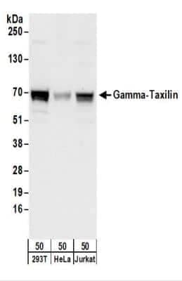 Western Blot: taxilin gamma Antibody [NBP2-22330] - Whole cell lysate (50 ug) from 293T, HeLa, and Jurkat cells.   NBP2-22330 used for WB at 0.1 ug/ml.  Detection: Chemiluminescence with an exposure time of 10 seconds.