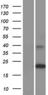 Western Blot tetraspanin 14 Overexpression Lysate