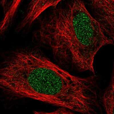 Immunocytochemistry/Immunofluorescence: TOX Antibody [NBP2-57848] - Staining of human cell line U-2 OS shows localization to nucleus.