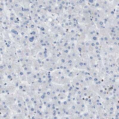 Immunohistochemistry-Paraffin: TOX Antibody [NBP1-87857] - Staining of human liver shows no positivity in hepatocytes as expected.