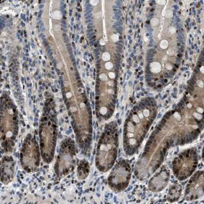 Immunohistochemistry-Paraffin: TOX Antibody [NBP1-87857] - Staining of human duodenum shows strong nuclear positivity in a subset of glandular cells.