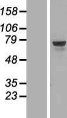 Western Blot: TOX Overexpression Lysate [NBL1-17200] - Left-Empty vector transfected control cell lysate (HEK293 cell lysate); Right -Over-expression Lysate for thymocyte selection-associated high mobility group box.