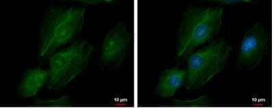 Immunocytochemistry/Immunofluorescence: transgelin 2 Antibody [NBP2-20697] - A549 cells were fixed in ice-cold MeOH for 5 min. Green: Transgelin 2 protein stained by Transgelin 2 antibody [N1C3]  diluted at 1:500. Blue: Hoechst 33342 staining. Scale bar = 10 um.