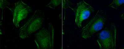 <b>Genetic Strategies Validation. </b>Immunocytochemistry/Immunofluorescence: transgelin 2 Antibody [NBP2-20697] - HeLa cells were fixed in 4% paraformaldehyde at RT for 15 min. Green: Transgelin 2 protein stained by Transgelin 2 antibody [N1C3] diluted at 1:500. Red: phalloidin, a cytoskeleton marker, stained by phalloidin (invitrogen, A12380) diluted at 1:200.Blue: Hoechst 33342 staining.