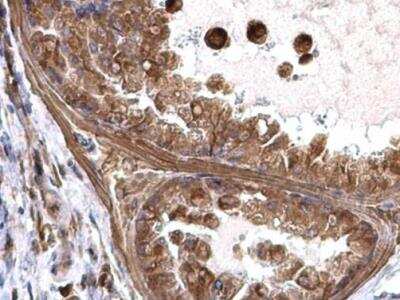 Immunohistochemistry-Paraffin: transgelin 2 Antibody [NBP2-20697] - Paraffin-embedded mouse prostate.  Transgelin 2 antibody [N1C3] diluted at 1:500.