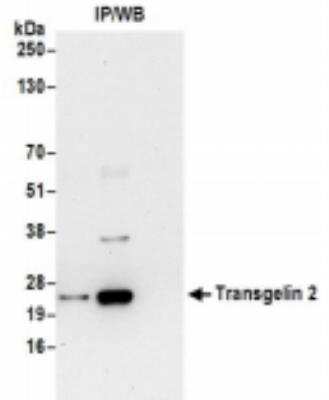 <b>Biological Strategies Validation. </b>Immunoprecipitation: transgelin 2 Antibody [NBP2-36550] - Samples: Whole cell lysate (0.5 or 1.0 mg per IP reaction; 20% of IP loaded) from 293T cells prepared using NETN lysis buffer. For blotting immunoprecipitated Transgelin 2, it was used at 0.1 ug/ml. Detection: Chemiluminescence with an exposure time of 30 seconds.