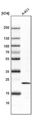 Western Blot: transgelin 2 Antibody [NBP1-89722] - Analysis in human cell line A-431.