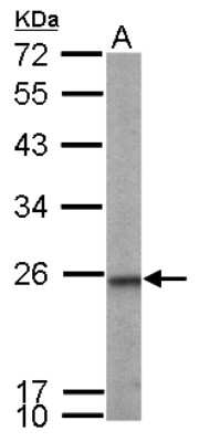 Western Blot: transgelin 2 Antibody [NBP2-20697] - Sample (50 ug of whole cell lysate) A: Mouse Brain, 12% SDS PAGE gel, diluted at 1:1000.