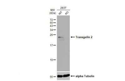 Western Blot: transgelin 2 Antibody [NBP2-20697] - Wild-type (WT) and Transgelin 2 knockout (KO) 293T cell extracts (30 ug) were separated by 15% SDS-PAGE, and the membrane was blotted with Transgelin 2 antibody diluted at 1:1000. HRP-conjugated anti-rabbit IgG antibody was used to detect the primary antibody.