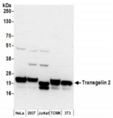 Western Blot: transgelin 2 Antibody [NBP2-36550] - Samples: Whole cell lysate (50 ug) from HeLa, 293T, Jurkat,  mouse TCMK-1, and mouse NIH3T3 cells prepared using NETN lysis buffer. Antibodies: Affinity purified rabbit anti-Transgelin 2 antibody used for WB at 0.1 ug/ml. Detection: Chemiluminescence with an exposure time of 10 seconds.