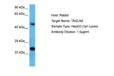 Western Blot: transgelin 2 Antibody [NBP2-88459] - Host: Rabbit. Target Name: TAGLN2. Sample Tissue: Human HepG2 Whole Cell. Antibody Dilution: 1.0ug/ml