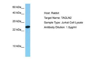 Western Blot: transgelin 2 Antibody [NBP2-88461] - Host: Rabbit. Target Name: TAGLN2. Sample Tissue: Human Jurkat Whole Cell lysates. Antibody Dilution: 1ug/ml