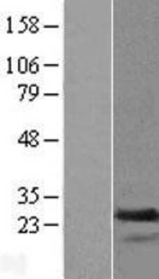 Western Blot: transgelin 2 Overexpression Lysate (Adult Normal) [NBL1-16693] Left-Empty vector transfected control cell lysate (HEK293 cell lysate); Right -Over-expression Lysate for transgelin 2.