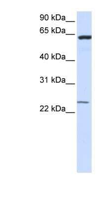 Western Blot: transmembrane protein 138 Antibody [NBP1-59523] - Human Brain lysate, concentration 0.2-1 ug/ml.