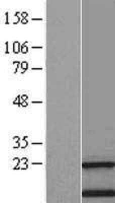 Western Blot: transmembrane protein 138 Overexpression Lysate (Adult Normal) [NBL1-17012] Left-Empty vector transfected control cell lysate (HEK293 cell lysate); Right -Over-expression Lysate for transmembrane protein 138.