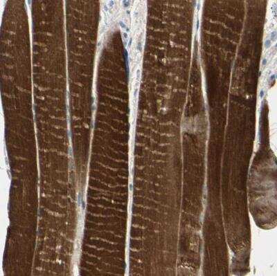 Immunohistochemistry-Paraffin: tropomyosin-3 Antibody [NBP1-87382] - Staining of human skeletal muscle shows strong cytoplasmic positivity in myocytes.