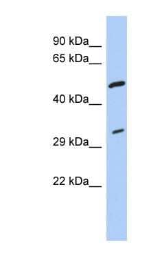 Western Blot: tropomyosin-3 Antibody [NBP1-57472] - THP-1 cell lysate, concentration 0.2-1 ug/ml.