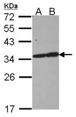 <b>Genetic Strategies Validation. </b>Western Blot: tropomyosin-3 Antibody [NBP2-20732] - Sample (30 ug of whole cell lysate) A: 293T B: A431 12% SDS PAGE gel, diluted at 1:1000.