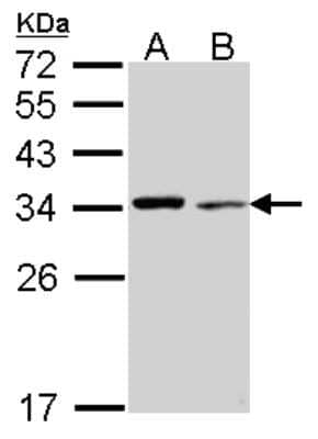 Western Blot: tropomyosin-4 Antibody [NBP2-15146] - Sample (30 ug of whole cell lysate) A: NT2D1 B: Hela 12% SDS PAGE; antibody diluted at 1:1000.